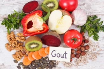 خوراکی های موثر در درمان بیماری نقرس کدامند ؟