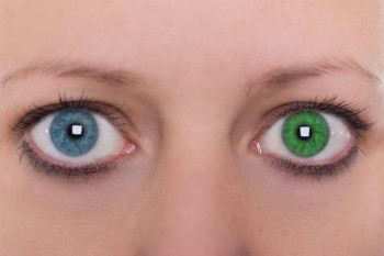 ۱۰ دلیل اصلی که باعث تغییر رنگ چشم میشود کدامند ؟