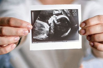 سونوگرافی آنومالی جنین چیست و چه زمانی انجام میشود ؟