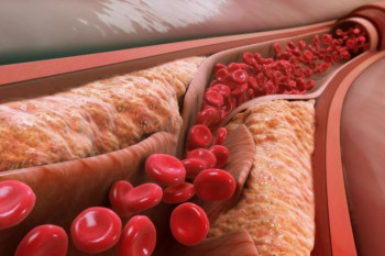 میزان نرمال سطح کلسترول خون در هر فرد چه قدر است ؟