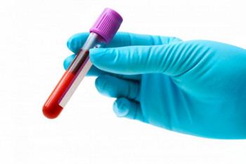 MCHC در آزمایش خون به چه معناست ؟
