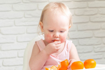 همه چیز درباره حساسیت غذایی در نوزادان