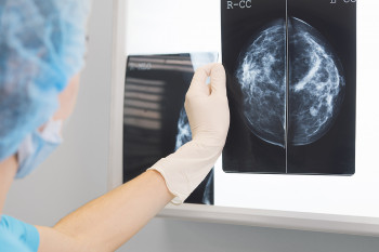 تفاوت و مقایسه ماموگرافی و ترموگرافی جهت تشخیص سرطان سینه
