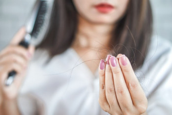 چگونه ریزش موی ناشی از کرونا را درمان کنیم ؟