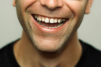 فاصله بین دندانی یا دیاستما چیست؟