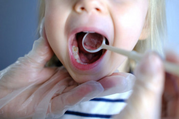علت سیاهی دندان در کودکان چیست؟