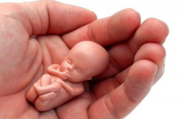 پرسش و پاسخ به سوالات مربوط به غسل و احکام شرعی بعد از سقط جنین