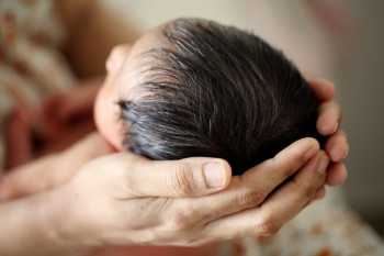 آیا ریزش پوست سر نوزاد طبیعی است؟