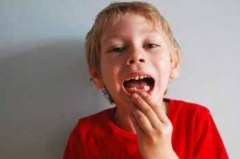 چند دلیل دیر افتادن دندان‌ شیری کودکان