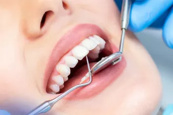 مراجعه زن به دندانپزشک مرد در اسلام چه حکمی دارد؟