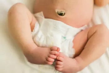 نگهداری از خون بند ناف به چه صورت است ؟