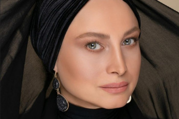 تغییر چهره شدید مریم کاویانی بعد از جراحی افتادگی پلک و عمل های زیبایی !!!