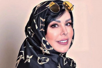 شباهت بی حد و حصر فلور نظری قبل از عمل و لیفت های زیاد به مادرش !!
