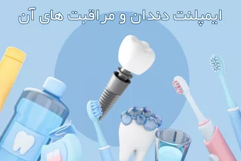 ایمپلنت دندان و مراقبت آن ( + جراحی، تغذیه و نگهداری )