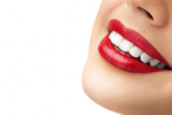 پرکردن دندان با مواد سفید خوبه یا سیاه ؟