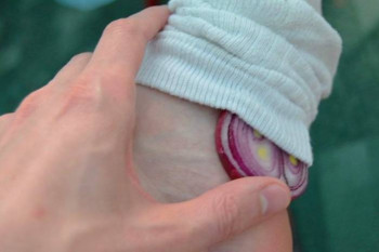 10 روش پایین آوردن تب کودک با پیاز