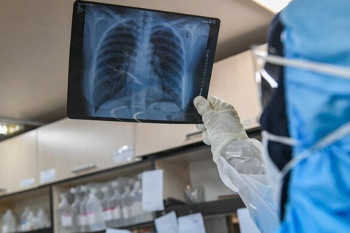 پزشکان فوق تخصص ریه در یاسوج به همراه آدرس و تلفن