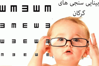 لیست بینایی سنجی های گرگان به همراه آدرس و تلفن