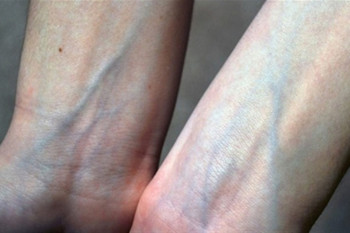 چرا رگ های بدن آبی هستند ؟