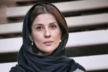 تغییر چهره شدید خانم بازیگر بعد از عمل بینی!