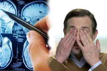 مالش چشم در MRI چگونه به نظر می رسد!؟