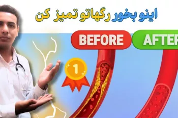 باز کردن عروق قلب بدون آنژیوپلاستی !