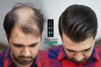 مدل مو برای موهای بسیار نازک و طاس با استفاده از الیاف مو !