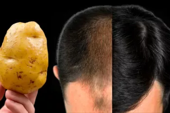 موها دیوانه وار رشد می کنند و نمی ریزند! / این قدرتمندترین ماسک مو است!