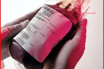 انتقال خون چطور انجام می‌شود؟