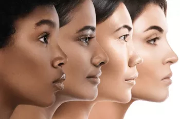 چرا نژادهای مختلف، رنگ پوست متفاوتی دارند؟