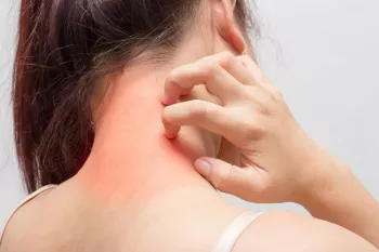 زمانی که احساس خارش می‌کنیم چه اتفاقی در بدن می‌افتد؟