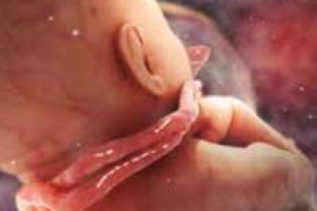 عوارض پیچ‌خوردگی بند ناف بر جنین و نوزاد