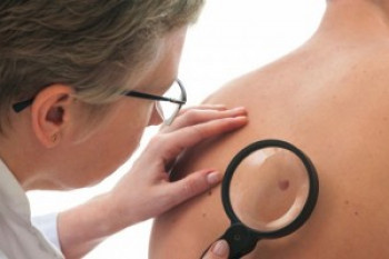 آیا میدانید علائم هشدار دهنده سرطان پوست کدام است؟