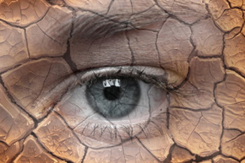 خشکی چشم چیست؟آیا از نحوه جلوگیری از خشکی چشم آگاهی دارید؟