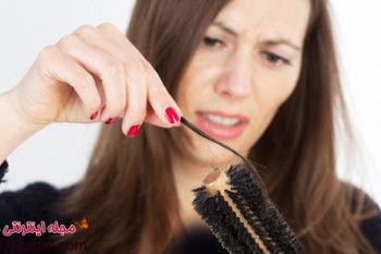 کاهش ریزش مو و بررسی دلیل اصلی