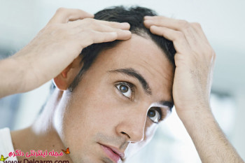 کندن موهای سفید و افزایش آن