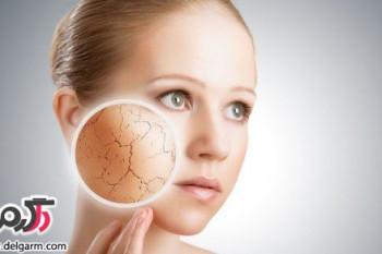 توصیه های طب سنتی برای پوست های خشک
