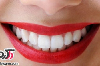 چگونه دندان هایتان را سفید کنید؟