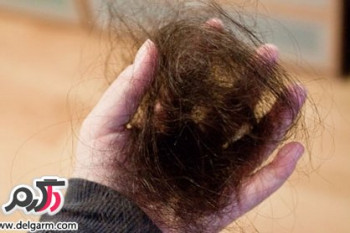 میزان طبیعی ریزش موی روزانه