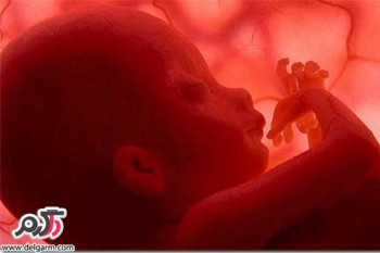 علت خونریزی جنین در رحم مادر چیست؟