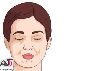 علت تورم صورت چیست؟