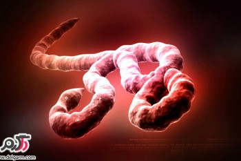 علائم و درمان بیماری ابولا