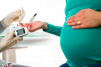 عوارض آسپارتام (شیرین کننده های مصنوعی)در دوران بارداری