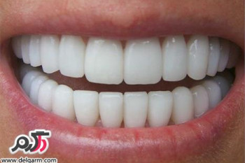 مضرات پودرهای سفید کننده دندان چیست؟