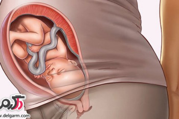 علت حرکت نکردن جنین در شکم مادر