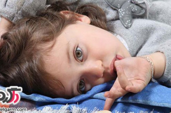 علت؛پیشگیری و درمان کرمک در کودکان