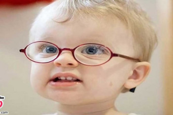علت و درمان انحراف چشم در کودکان