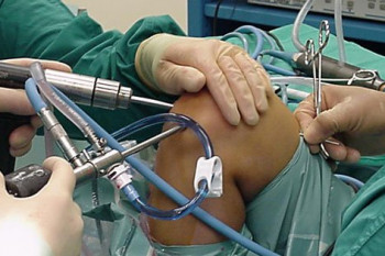 پارگی و کشیدگی رباط‌های زانو +درمان(عمل جراحی)