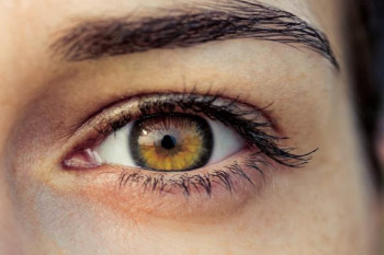 درمان دانه های چربی سفید زیر چشم