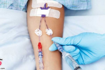 آنژیوکت یا کاتتر عروق محیطی( peripheral venous catheter)چیست؟